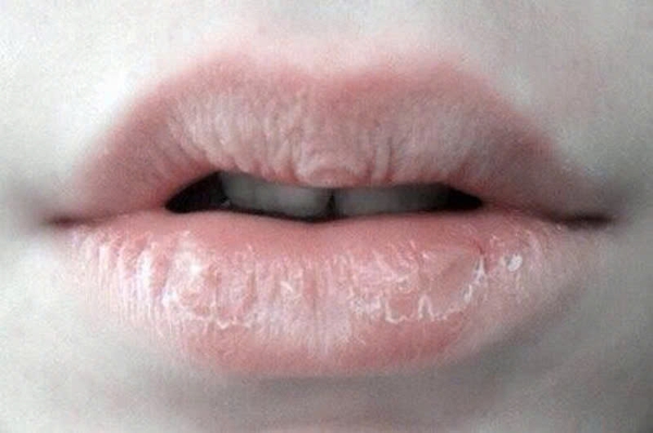 Hình ảnh bài viết