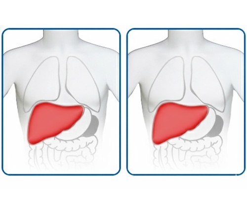 Âm gan tăng là gì có nguy hiểm không?