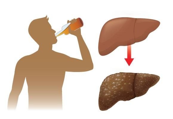 Cách giải độc sau khi uống rượu bia nhanh nhất