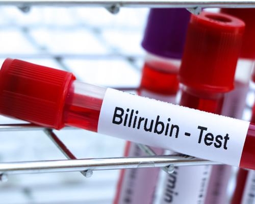 Chỉ số Bilirubin là gì? Cảnh báo 5 bệnh lý gan mật nguy hiểm