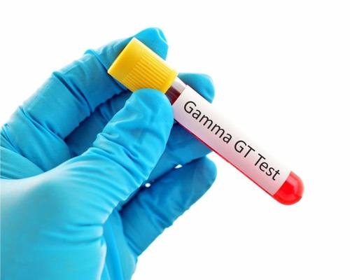 Chỉ số GGT là gì? Ý nghĩa đối với gan mật