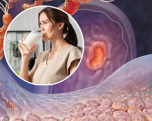 Viêm loét dạ dày có uống sữa được không? Giải đáp và lưu ý quan trọng