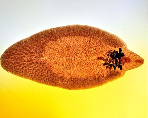 Sán lá gan gây bệnh gì? Cách nhận biết và phòng tránh