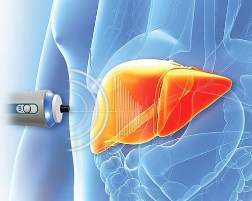 Siêu âm gan to là bệnh gì? Nguyên nhân và dấu hiệu cảnh báo nguy hiểm