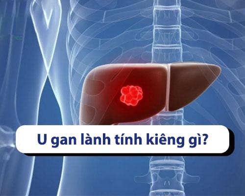 U gan lành tính kiêng ăn gì? 5 thực phẩm cần tránh
