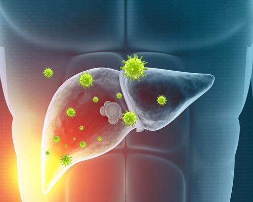 Viêm gan siêu vi B là gì, có lây không?