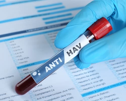 Xét nghiệm HAV là gì? Ý nghĩa và kết quả cần biết năm 2026
