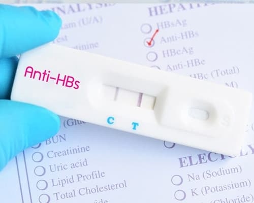 Xét nghiệm kháng thể viêm gan B là gì và khi nào cần làm