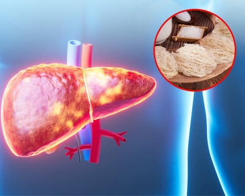 Xơ gan ăn được yến không? Có lợi hay nguy hiểm?