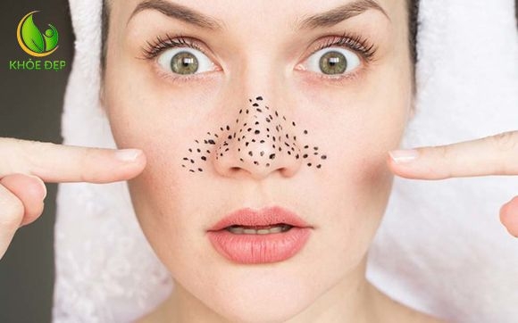 GEL LỘT MỤN KOSE _Gel 25g Nhật Bản