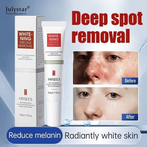 KEM BÔI NÁM HIISEES DƯỠNG ẨM TRẮNG DA, MỜ THÂM NÁM TÀN NHANG WHITE NING - GDN