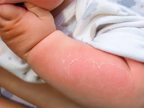 HƯỚNG DẪN CÁCH PHÒNG TRÁNH CÁC TAI NẠN THƯỜNG GẶP TRONG NHÀ VÀ SƠ CỨU CƠ BẢN CHO BÉ