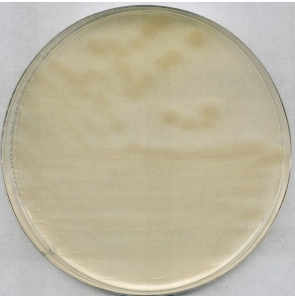 R2A Agar for microbiology