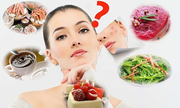 Da Đang Nổi Mụn Nên Kiêng Gì? Danh Sách Thực Phẩm Làm Mụn Bùng Phát Bạn Phải Biết