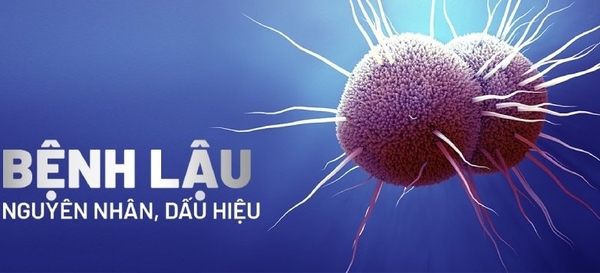 Các Giai Đoạn Của Bệnh Lậu: Triệu Chứng Theo Từng Giai Đoạn Và Cách Điều Trị
