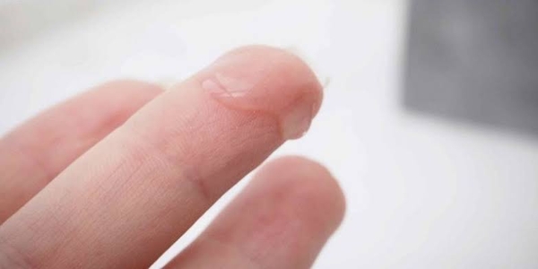 Chất Nhầy Cổ Tử Cung Là Gì? Vai Trò, Sự Thay Đổi Theo Chu Kỳ Và Dấu Hiệu Bất Thường