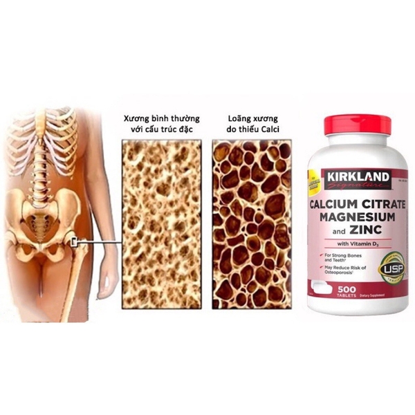 VIÊN UỐNG CALCIUM CITRATE MAGNESIUM AND ZINC