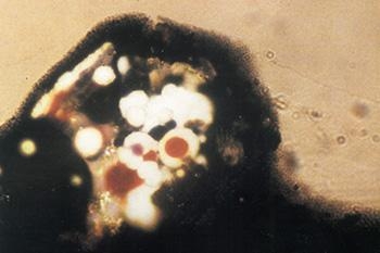 LỖI DO SƠN THỪA ĐỌNG LẠI (OVERSPRAY CLUSTERS)