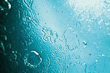 LỖI ĐỐM NƯỚC (WATER SPOTTING)