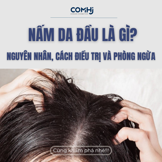 NẤM DA ĐẦU LÀ GÌ? NGUYÊN NHÂN, CÁCH ĐIỀU TRỊ VÀ PHÒNG NGỪA