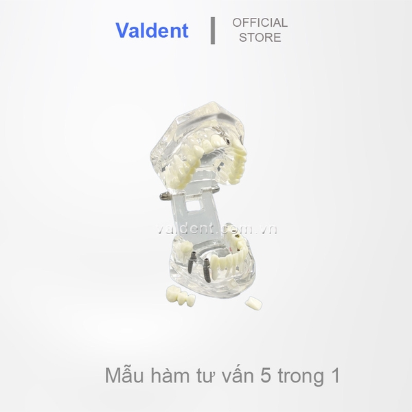 Mẫu hàm tư vấn bệnh lý nha khoa 5 trong 1