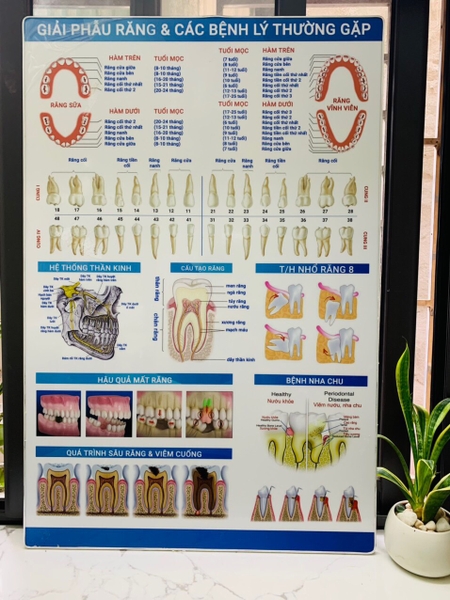 Tranh tư vấn nha khoa-Tranh trang trí phòng khám