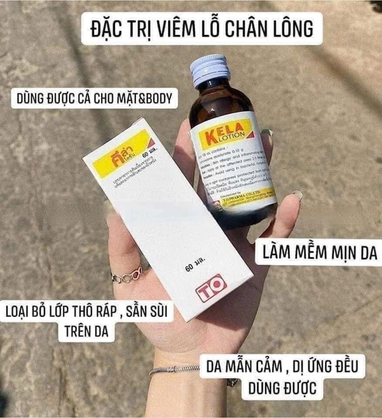 set-3-chai-kela-lotion-dac-tri-viem-lo-chan-long-c25072510