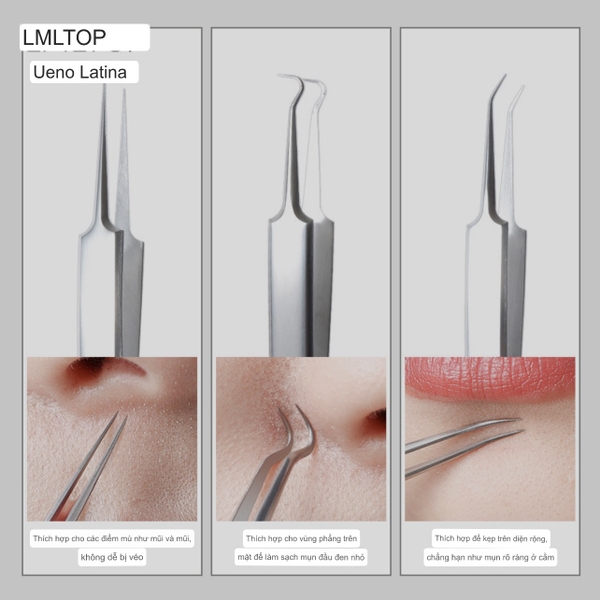 nhip-gap-mun-than-thanh-47-5k-c-n23081302