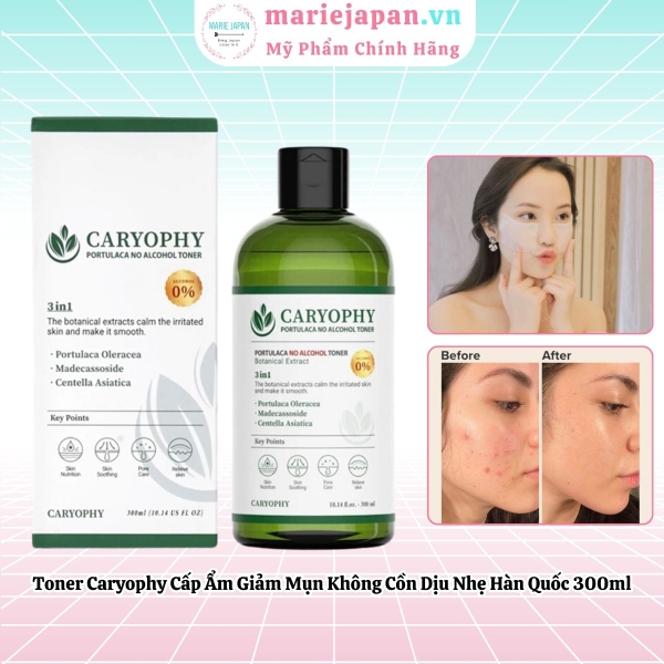Toner Caryophy 3in1 Portulaca Cấp Ẩm Giảm Mụn Không Cồn Dịu Nhẹ Hàn Quốc 300ml