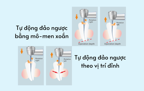 C-Smar Mini AP với chế độ auto reverse tự động đảo chiều khi gặp lực cản