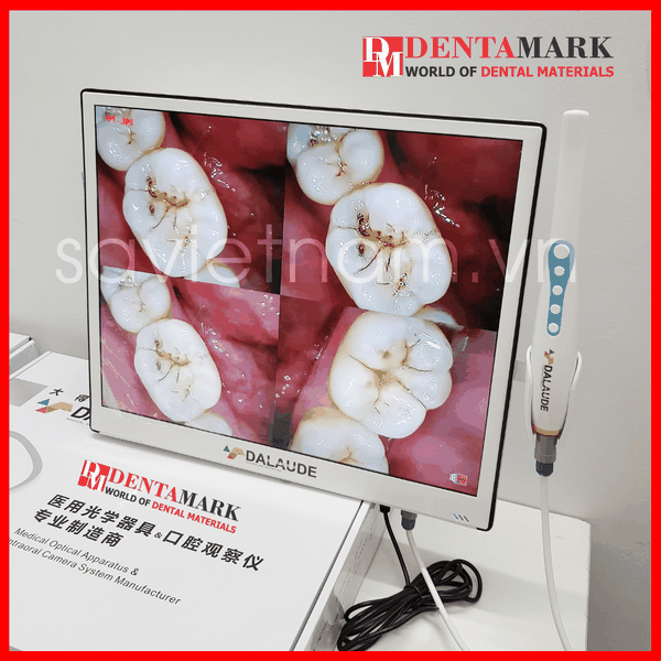 Camera Soi Răng 17" DALAUDE DA300 dentamark.vn