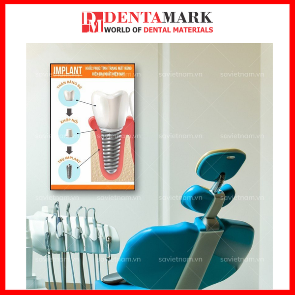 Tranh nha khoa Implant trang trí phòng khám 4.2
