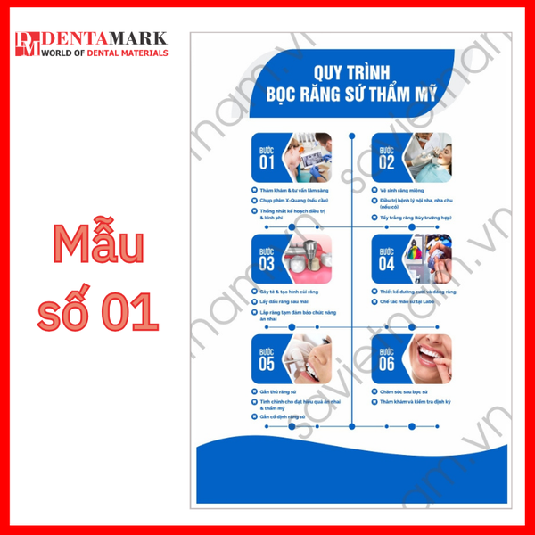Tranh nha khoa - Tranh quy trình nha khoa - Quy trình bọc răng sứ thẩm mỹ - dọc