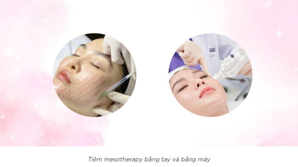 So sánh tiêm máy và tiêm tay: Lựa chọn nào tối ưu khi cấy tinh chất?