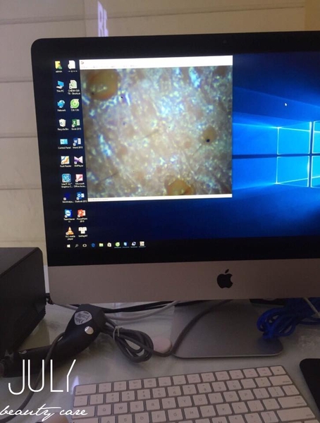 Sự thật về lăn kim