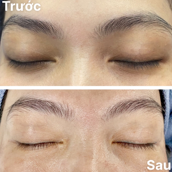 Công nghệ đột phá giúp đánh bay nếp nhăn và quầng thâm mắt - Young Eye Jalupro kết hợp Gouri và Master Tech Eye tại TA Beauty+!