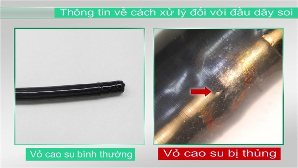 Xử lý phần đầu dây soi