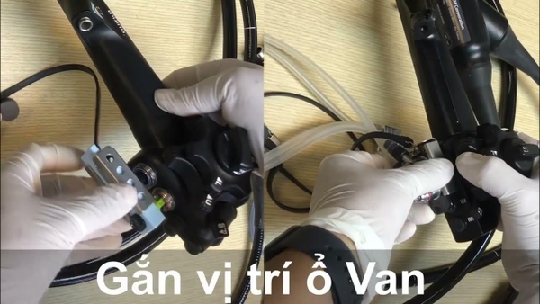 Vệ sinh dây ERCP