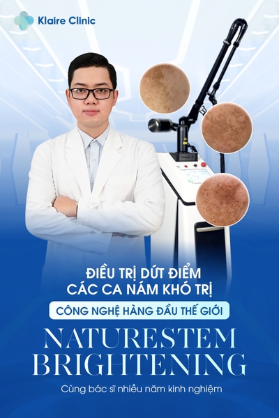 trị nám