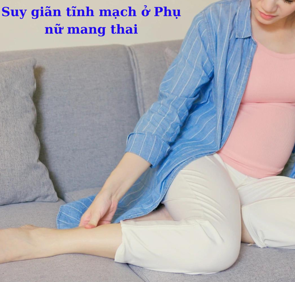 GIÃN TĨNH MẠCH Ở PHỤ NỮ MANG THAI