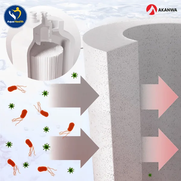 Loại bỏ tạp chất, cặn bẩn của nguồn nước đầu vào