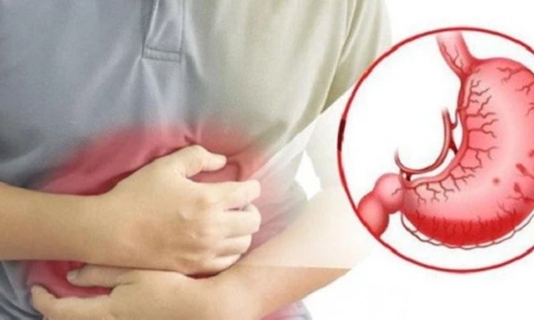 Điều trị viêm loét dạ dày tại nhà