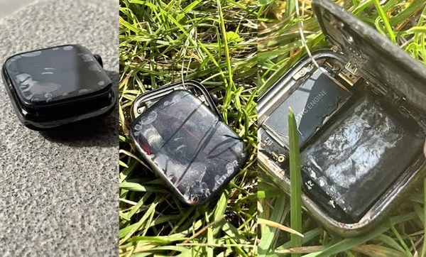 Apple Watch phát nổ khiến chủ nhân phải đi cấp cứu