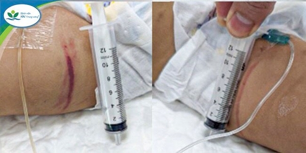 Khởi tố cặp đôi đánh, bịt băng dính vào miệng bé gái 1 tuổi ở Hà Nội