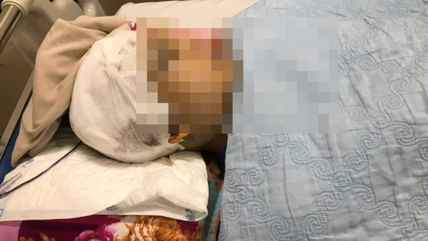 Phó Chủ tịch UBND xã ở Hải Dương bị đánh trọng thương khi làm nhiệm vụ AN NINH HÌNH SỰChủ Nhật, 17/04/2022 19:20:33 +07:00