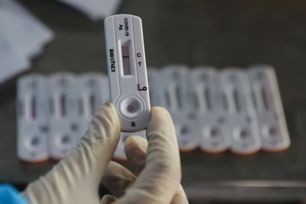 Đề xuất hai phương án mua kit xét nghiệm cho TP HCM