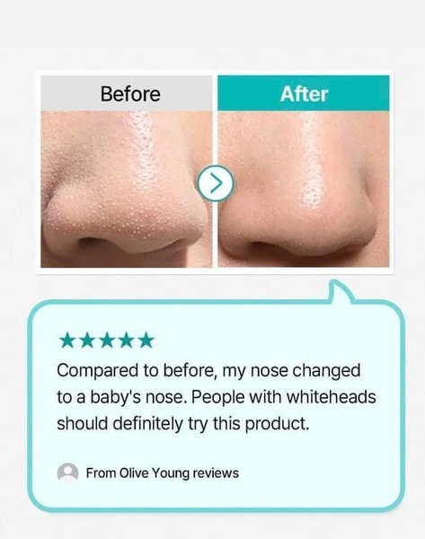 Thanh gạt mụn Hàn Quốc ILSO DEEP CLEAN MASTER