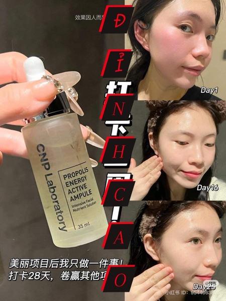 Tinh chất keo ong CNP Laboratory Propolis Active Ampule fullsize 30ml bản tặng kèm tất