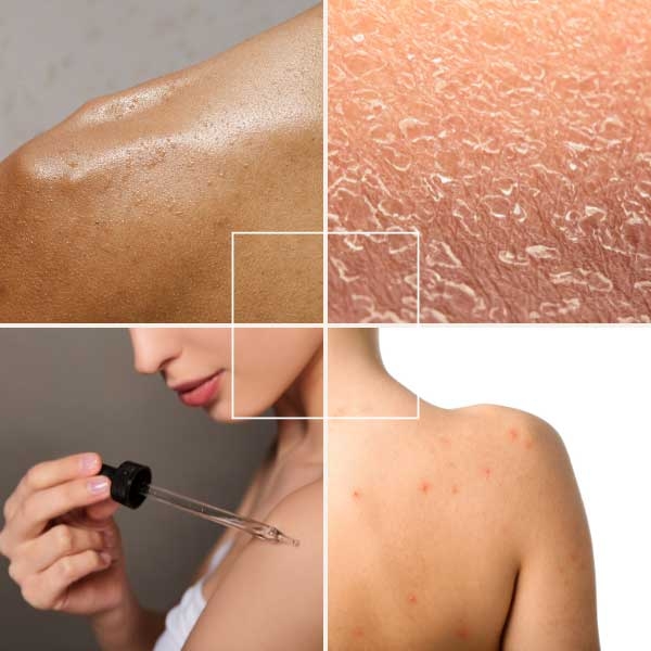 các loại da của cơ thể
