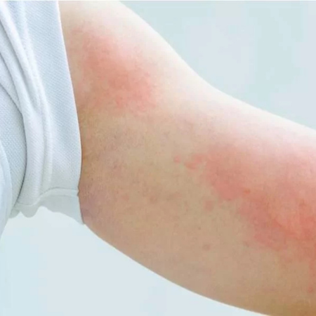 Làn Da Của Bạn Có Đang 